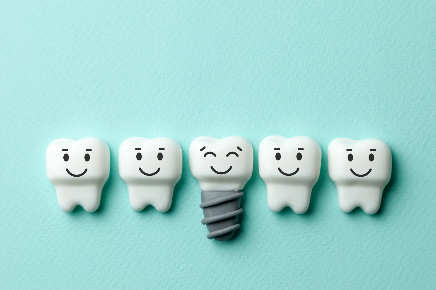 Jakie są rodzaje implantów zębowych?