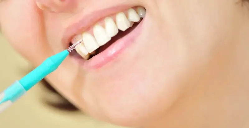 Zabiegi dentystyczne refundowane przez NFZ