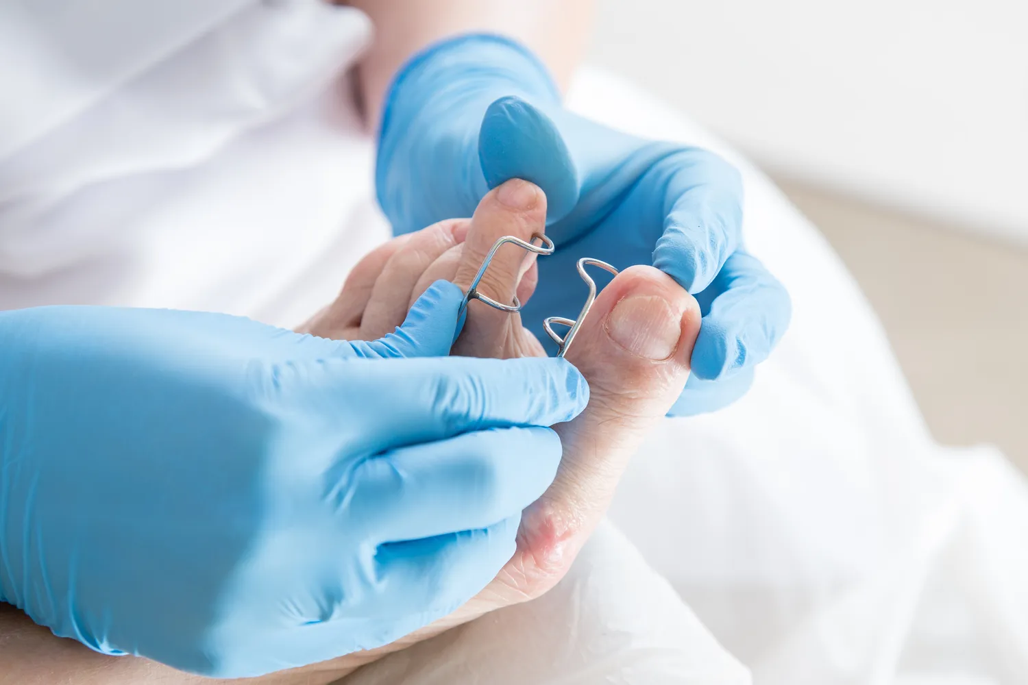 Pedicure leczniczy - co na ten temat wiedzieć trzeba?